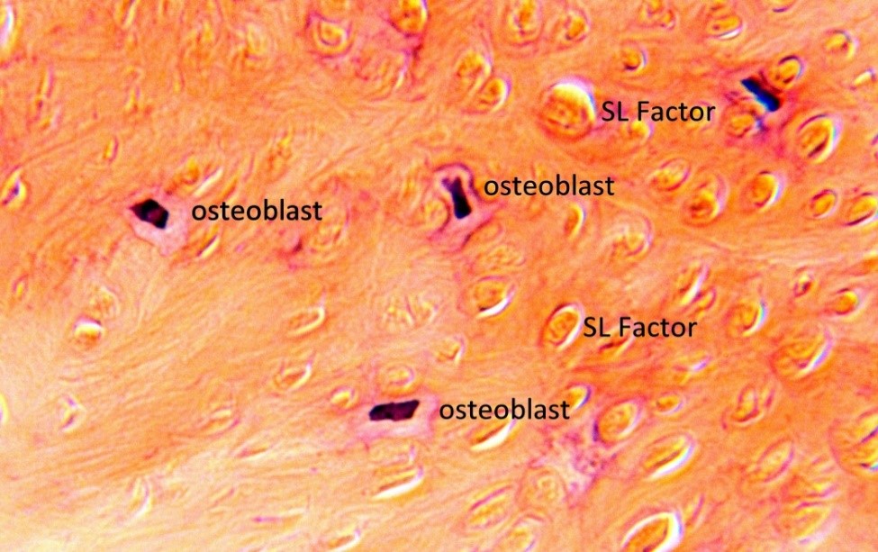 What is a Bone Graft?