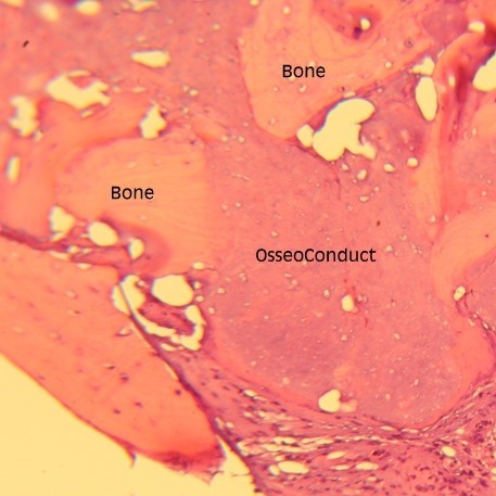 OsseoConduct Histology