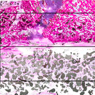 Synthetic Alternative to Autograft