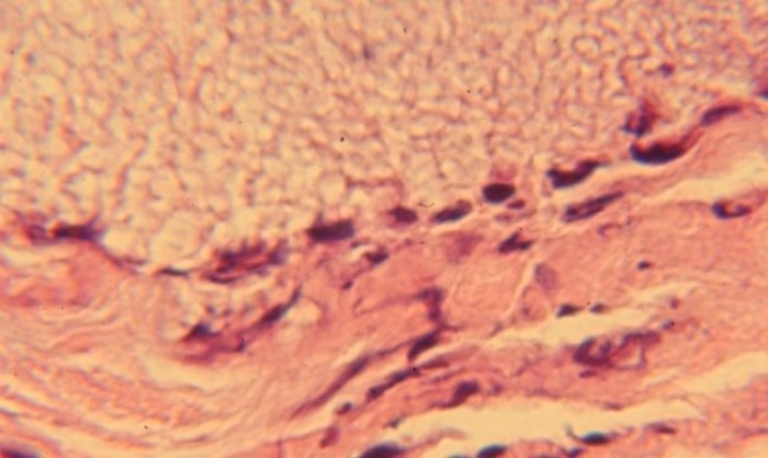 Histology of core sample, 40 days
