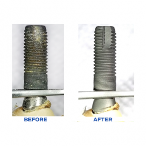 failed implant with retained cement cleaned with βTCP air abrasion