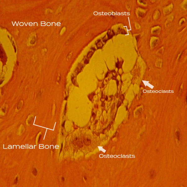 synthetic dental bone graft histology showing osteoclasts resorbing bone and lamellar bone formation
