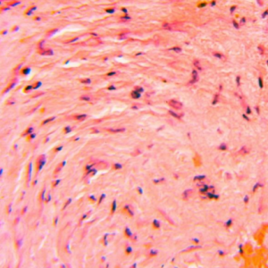 Collagen plug at 4 weeks