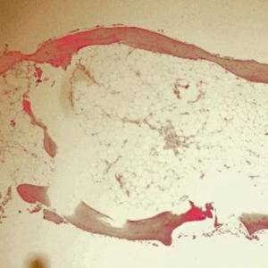 low power histology of a trephine core sample showing poorly mineralized human cancellous bone