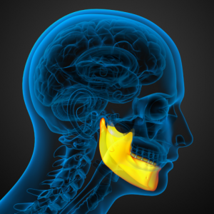 Osteonecrosis of the Jaw: Etiology and Prevention