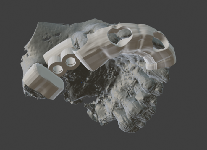 3D rendered surgical guide design for dental implant