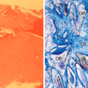 Literature Comparison: SteinerBio and NovaBone