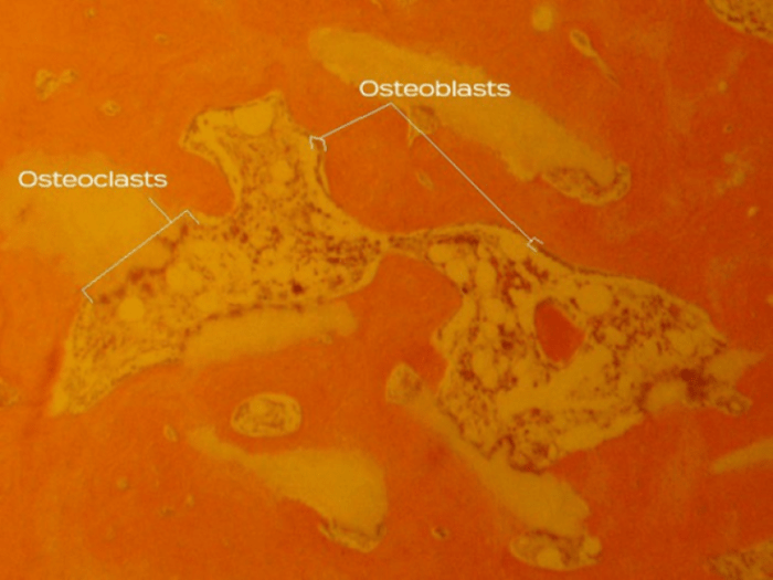 osteoclasts on surface of βTCP particle and osteoblasts forming lamellar bone