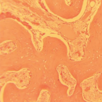 socket regeneration